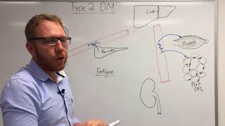 Type 2 Diabetes Pathophysiology [upl. by Waechter]