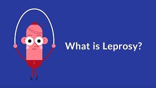 What is Leprosy Chronic Infectious Disease [upl. by Gladine194]