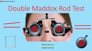 Double Maddox Rod Test [upl. by Breanne547]