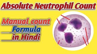 Total Leukocyte Count  TLC Blood Test Procedure  Total WBC Count Experiment [upl. by Sikorski302]