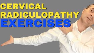 Best Cervical Radiculopathy Exercises  Exercises For Cervical Radiculopathy Dr Walter Salubro [upl. by Rosenblatt]