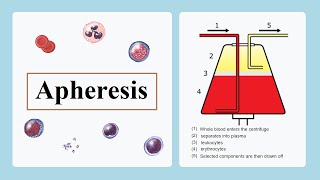 apheresis [upl. by Noonberg62]