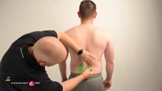 Kinesiology Taping For Low Back Pain [upl. by Cantu]