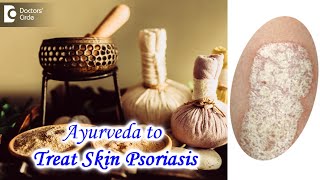 Ayurvedic Treatment for managing Skin Psoriasis  PSORIASIS  Dr Chaithanya K S  Doctors Circle [upl. by Eduj]