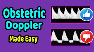 Obstetric Doppler Made Easy [upl. by Aicekal]