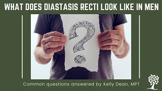 What Diastasis Recti Looks Like in Men [upl. by Padget]