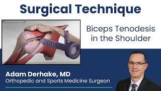 Biceps Tenodesis in the Shoulder Surgical Technique [upl. by Breh783]