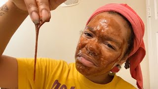 I Tried Cinnamon And Honey On My Face For 1 Week  DOES IT REALLY WORK  Acne treatment [upl. by Buchanan]