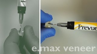 Predictable Porcelain Veneer Cementation [upl. by Stodder]