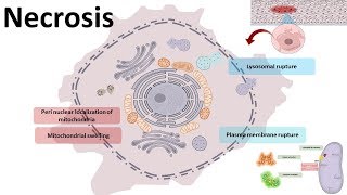 Necrosis  cellular mechanism and types [upl. by Tanney]