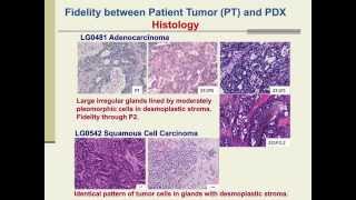 Graft rejection  Immunological basis of graft rejection [upl. by Eniluqcaj]