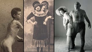 The Dark History of FREAK SHOWS [upl. by Lillis]