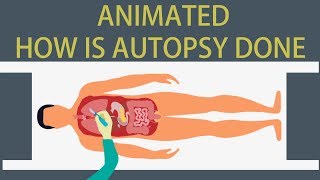 Autopsy Detailed animation on how is Autopsy done [upl. by Anetta]