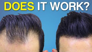 Does Hair Fiber SPRAY Work BETTER Hair Coverage [upl. by Laughlin]