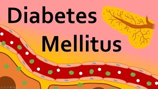 What is Diabetes Mellitus [upl. by Sissy]