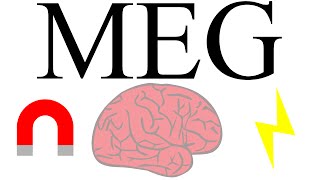 Magnetoencephalography measuring brain activity with magnetism [upl. by Dusty]