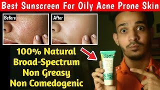 Oily Acne Prone Sensitive Skin के लिए सबसे अच्छा Sunscreen  Aroma Magic Aloe Vera Sunscreen Review🔥 [upl. by Eiramalegna43]