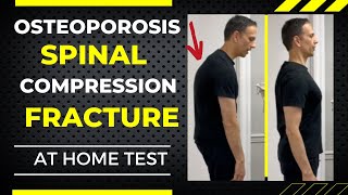 Spinal Compression Fracture From Osteoporosis Is it too LATE [upl. by Dnalra978]