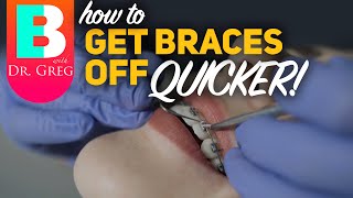 Getting Braces Off Quicker [upl. by Marcel]