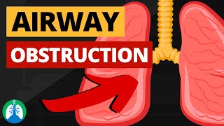 Airway Obstruction Medical Definition  Quick Explainer Video [upl. by Annai895]