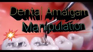 Dental Amalgam Manipulation [upl. by Atnas]