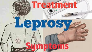 What is Leprosy  What causes Leprosy  Leprosy Diagnosis [upl. by Sigismund]