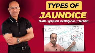 Types Of Jaundice  Causes Symptoms amp Treatment  Dr Najeeb [upl. by Fadas]