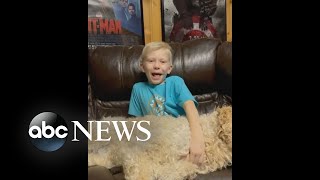 Hero 6yearold boy bitten by dog shares update  WNT [upl. by Aritak160]