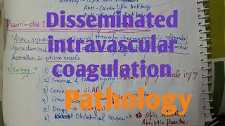 Disseminated Intravascular Coagulation DIC Pathology [upl. by Nefen349]