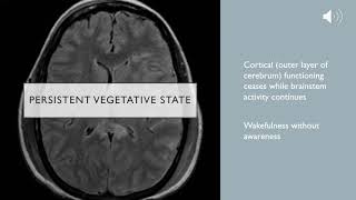 Clinical Death Whole Brain Death and Persistent Vegetative State [upl. by Jerrilyn620]