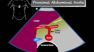 How to Scan the Aorta [upl. by Marco]