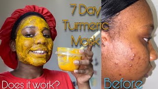 7 Day Turmeric Face Mask For Dark Spots  Honest Review [upl. by Sherline]