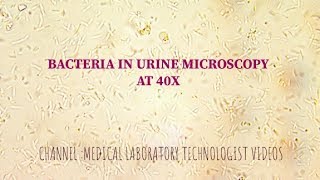 Bacteria under urine microscopy at 40X UTI [upl. by Florina]