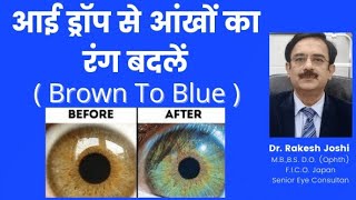 Eye color change by eye drops from brown to blue [upl. by Ulrich501]