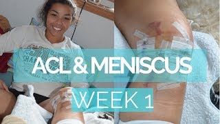 ACL amp Meniscus Recovery Vlog Week 1 Post Op [upl. by Tharp563]