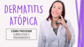 Dermatitis Atópica  Cómo Curar la Piel Atópica [upl. by Oicinoid]