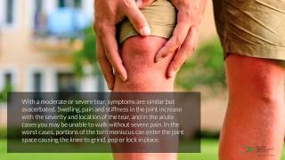 Discoid Meniscus Injuries  FAQ with Dr R Jay Lee [upl. by Aztiraj492]