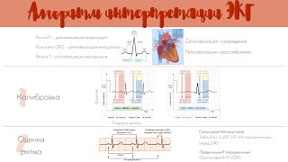 Научись читать ЭКГ за 14 минут Простой алгоритм интерпретации ЭКГ [upl. by Fisher230]