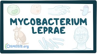 Mycobacterium leprae  an Osmosis Preview [upl. by Quince430]