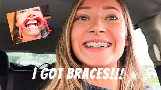 FINALLY GETTING BRACES ON VLOG 2023 [upl. by Aelem170]