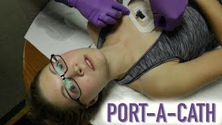 How To Ultrasound Guided Paracentesis Procedure 3D Video [upl. by Otineb452]