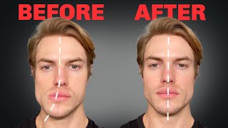 How to Fix Asymmetrical Jaw amp Face FOREVER [upl. by Ahtanoj]