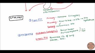 Hypercalcemia for USMLE Step 1 and USMLE Step 2 [upl. by Sonja988]