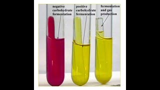 Phenyl red broth test  Carbohydrate fermentation test [upl. by Amaryl]