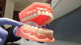 UniversalNational Tooth Numbering System [upl. by Drucilla]