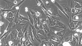 Beating Cardiomyocytes Isolated from neonatal rat heart [upl. by Rosco899]