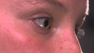 Scleral Contact Lenses  Eye Doctor Explains Sclerals [upl. by Latt61]