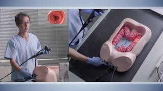 Basics of colonoscopy [upl. by Eppes237]