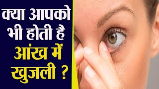 Eye Itching Home Remedy आंखों में खुजली हो तो क्या करें  आंखों में खुजली के उपाय  Boldsky [upl. by Llacam]