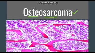 Osteosarcoma GeneralMorphology SubtypesClinical features [upl. by Cosma]